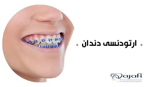 ارتودنسی دندان ها