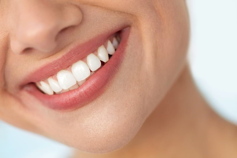 باندینگ دندان برای چه کسانی مناسب است؟