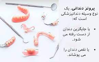 انواع پروتز دندانی
