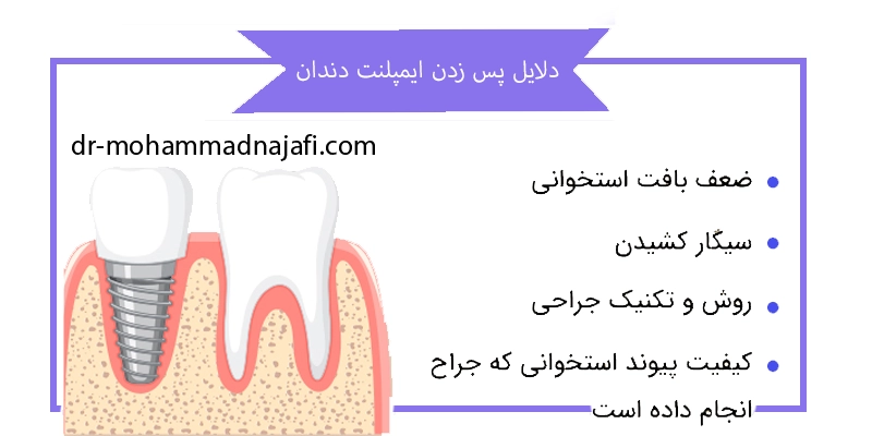 دلایل پس زدن ایمپلنت دندان