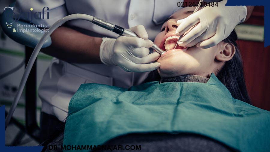 هزینه عمل جراحی افزایش طول تاج دندان