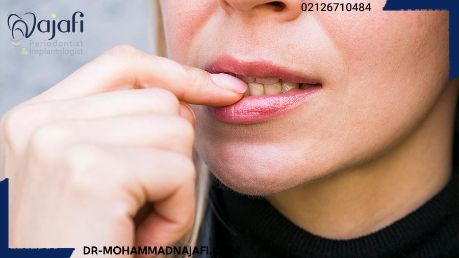 روش های درمان آبسه دهان
